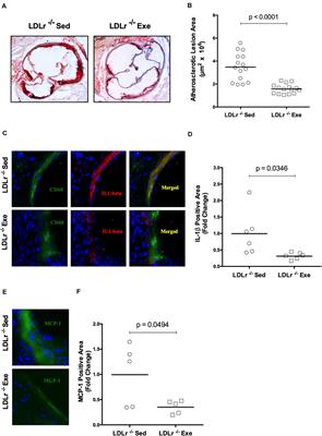 The Anti-atherogenic Role of Exercise Is Associated With the Attenuation of Bone Marrow-Derived Macrophage Activation and Migration in Hypercholesterolemic Mice